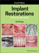 C Drago, Carl Drago, Drago Carl - Implant Restorations
