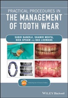 S Banerji, Subi Banerji, Subir Banerji, Subir (King''s College London Dental Inst Banerji, Subir Mehta Banerji, Banerji Subir... - Practical Procedures in the Management of Tooth Wear