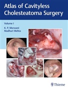 Madhuri Mehta, Morwani, K Morwani, K P Morwani, K. P. Morwani - Atlas of Cavityless Cholesteatoma Surgery, Vol 1