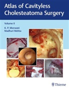 Madhuri Mehta, Morwani, K Morwani, K P Morwani, K. P. Morwani - Atlas of Cavityless Cholesteatoma Surgery, Vol 2. Vol.2