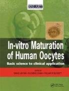 Seang Lin Chian Tan, M. Buckett, Buckett M., Ri-Chen Chian, Seang Lin Tan, Tan Seang Lin - In Vitro Maturation of Human Oocytes
