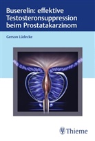Gerson Lüdecke - Buserelin: effektive Testosteronsuppression beim Prostatakarzinom