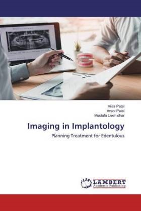Mustafa Laxmidhar, Avan Patel, Avani Patel, Vila Patel, Vilas Patel - Imaging in Implantology - Planning Treatment for Edentulous
