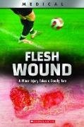 Shea Phillips - Flesh Wound: A Minor Injury Takes a Deadly Turn (XBooks)