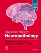 B. K. Kleinschmidt-Demasters, B.K. Kleinschmidt-DeMasters, Bette K Kleinschmidt-DeMasters, Kleinschmidt-DeMasters B., Melike Pekmezci, F. Rodriguez... - Diagnostic Pathology: Neuropathology
