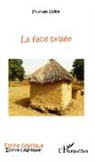 Soumaila Sidibe - Face brisée
