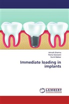 Rom Goswami, Roma Goswami, Sumit Makkar, Anirud Sharma, Anirudh Sharma - Immediate loading in implants
