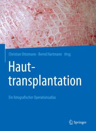 Hartmann, Hartmann, Bernd Hartmann, Christia Ottomann, Christian Ottomann - Hauttransplantation Ein fotografischer Operationsatlas