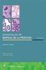 Jonathan I. Epstein - Interpretacion De Biopsias De La Prostata