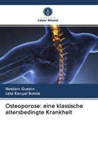 Neela Gusain, Neelam Gusain, Lata Kanyal Butola - Osteoporose: eine klassische altersbedingte Krankheit