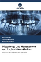 Amit Bhardwaj, Manis Dev, Manish Dev, Shalin Kapoor, Shalini Kapoor - Misserfolge und Management von Implantatkrankheiten