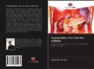 Sourav Kumar Das - Implantation d'un rein bio-artificiel