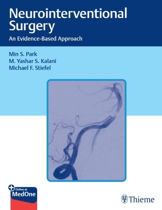 M Yashar Kalani, M. Yashar Kalani, M. Yashar S. Kalani, Min S Park, Min S. Park, Michael Stiefel - Neurointerventional Surgery - An Evidence-Based Approach