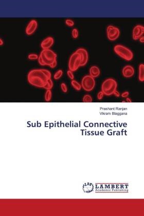 Vikram Blaggana, Prashant Ranjan - Sub Epithelial Connective Tissue Graft