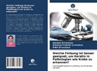 S, Amartya Prakas Srivastava, Amartya Prakash Srivastava, Ankit Srivastava, Aprajit Srivastava, Aprajita Srivastava - Welche Färbung ist besser geeignet, um Keratin in Pathologien wie Krebs zu erkennen?