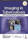 Rakesh K Gupta, Raju Sharma - Imaging in Tuberculosis