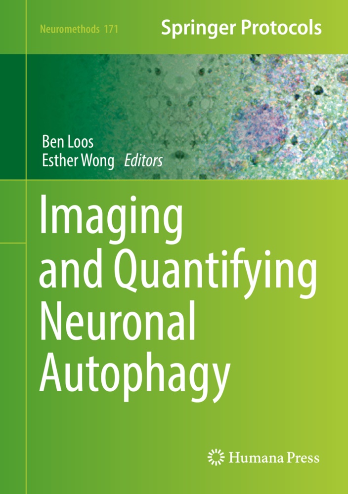 Be Loos, Ben Loos, Wong, Wong, Esther Wong - Imaging and Quantifying Neuronal Autophagy