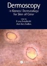 Enzo Lallas Errichetti, Enzo Errichetti, Aimilios Lallas - Dermoscopy in General Dermatology for Skin of Color
