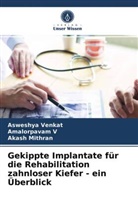 Akash Mithran, Amalorpava V, Amalorpavam V, Asweshy Venkat, Asweshya Venkat - Gekippte Implantate f&uuml;r die Rehabilitation zahnloser Kiefer - ein &Uuml;berblick