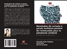Arvind Gulbake, Aviral Jain, Anamika Sahu Gulbake - Nanotubes de carbone à parois multiples portant de l'artésunate pour le paludisme cérébral