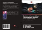 Bineet Kumar, Ravi Shankar Prasad, Rakesh Ranjan - Gestion de la mandibule complètement édentée avec des implants