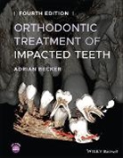 a Becker, Adrian Becker, Adrian (Department of Orthodontics At the Becker - Orthodontic Treatment of Impacted Teeth