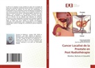 Djamila-Djahida Batouche, Djilali BATOUCHE, Amel-Soulef SAADI - Cancer Localisé de la Prostate en Post Radiothérapie