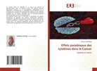 Wissam Djerboua - Effets paradoxaux des cytokines dans le Cancer