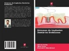 Meenakshi Khandelwal, Vikas Punia, Abhijit Sethia - Sistemas de Implantes Dentários Endósseos