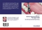 Sagar Sachdeva - Dental Implant Failures:The Ugly Truth