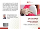 Sami El Khatib - Spectroscopie de Fluorescence des Tumeurs Cutanées Fluorescentes