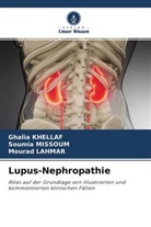 Ghali KHELLAF, Ghalia Khellaf, Mourad Lahmar, Soumi MISSOUM, Soumia Missoum - Lupus-Nephropathie