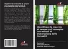 Debnath Bhattacharyya, Sushma D, Thirupathi Rao N - Identificare le macchie di sangue sull'immagine con metodi di elaborazione delle immagini