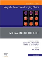 Mary K. Jesse, MK Jesse - MR Imaging of The Knee, An Issue of Magnetic Resonance Imaging Clinics of North America