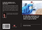 Derval Cumiskey - le rôle des cytokines sur la plasticité synaptique dans le gyrus denté