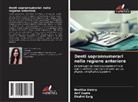 Shalini Garg, Anil Gupta, Neetika Verma - Denti soprannumerari nella regione anteriore
