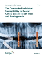 Alexandre Rezende Vieira, A R Buzalaf, A R Buzalaf, Marilia A.R. Buzalaf, Adria Lussi, Adrian Lussi - The Overlooked Individual: Susceptibility to Dental Caries, Erosive Tooth Wear and Amelogenesis