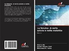 Omnia Aly, Hanan Hassan Zaki, Mohamed M. Hafez - La fetuina -A nella salute e nella malattia