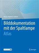 Marcus-Matthias Gellrich - Bilddokumentation mit der Spaltlampe