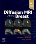 Mami Iima, Denis Le Bihan, Le Bihan Denis, Savannah Partridge, Savannah (Professor Partridge - Diffusion MRI of the Breast