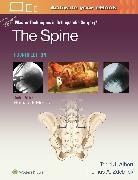 Todd Albert, Thomas A. Zdeblick - Master Techniques in Orthopaedic Surgery: The Spine