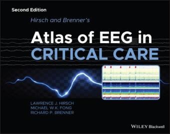 Rich Brenner, Richard Brenner, Richard P. Brenner, Michael W K Fong, Michael W. K. Fong, L J Hirsch... - Hirsch and Brenner''s Atlas of Eeg in Critical Care