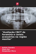 Ashish Chandra, Deepankar Misra, Shalu Rai - "Avaliação CBCT de foramina e canais acessórios na região maxilar"