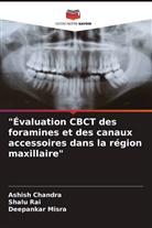 Ashish Chandra, Deepankar Misra, Shalu Rai - "Évaluation CBCT des foramines et des canaux accessoires dans la région maxillaire"