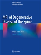 Paola D'Aprile, Alfredo Tarantino - MRI of Degenerative Disease of the Spine