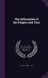William Anderson - The Deformities of the Fingers and Toes
