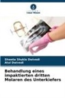 Atul Dwivedi, Shweta Shukla Dwivedi - Behandlung eines impaktierten dritten Molaren des Unterkiefers