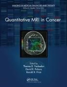 Thomas E. Pickens Yankeelov, David R. Pickens, Pickens David R., Ronald R. Price, Price Ronald R., Thomas E. Yankeelov... - Quantitative Mri in Cancer