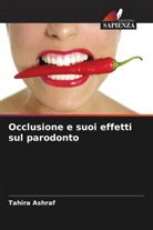Tahira Ashraf - Occlusione e suoi effetti sul parodonto