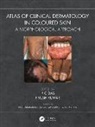 P C Kumar Das, P C Das, Piyush Kumar - Atlas of Clinical Dermatology in Coloured Skin